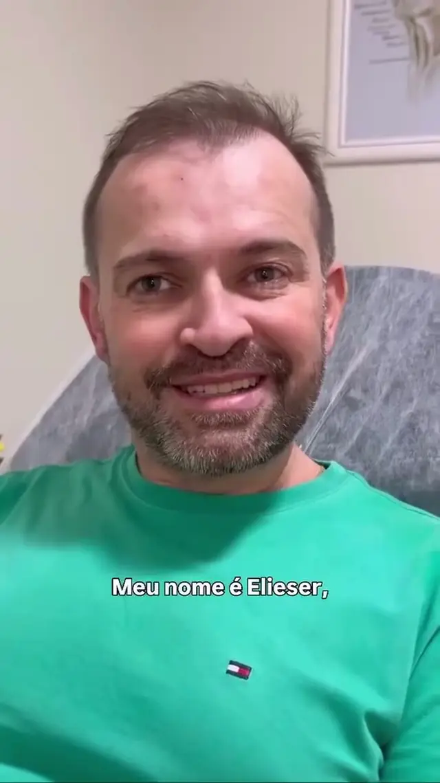 Depoimento de cliente da Shiva Zen sobre Botox